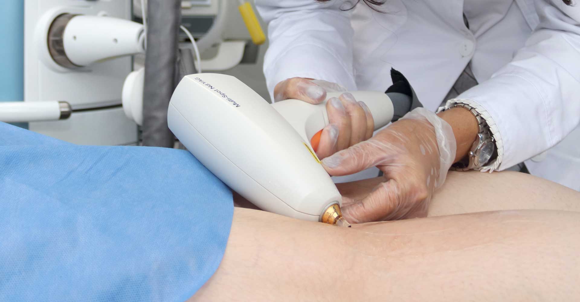 Lumenis Nd-YAG (Lesiones Vasculares)